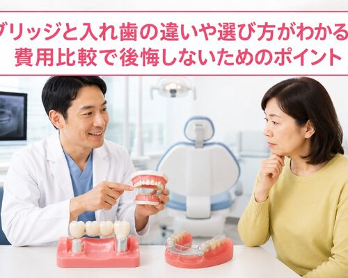 ブリッジ 入れ歯